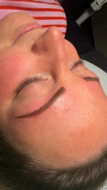 Powder Brows - schon nach der 1. Sitzung ein sichtbarer Unterschied ✨

Diese Kundin kam mit sehr feinen, lückenhaften Augenbrauen zu uns - wenig Dichte, kaum Form.

Nach der 1. Behandlung siehst du bereits ein deutlich volleres, definierteres Ergebnis - und genau das ist das Ziel: mehr Ausdruck, ohne unnatürlich zu wirken. 👁️

Wichtig zu wissen:
Direkt nach der Behandlung wirken die Brows immer etwas intensiver und dunkler.
Innerhalb der nächsten Wochen heilt alles ab und wird bis zu 60 % weicher - das finale Ergebnis entwickelt sich also noch.

Und genauso wichtig:
Jede Behandlung ist individuell.
Ausgangslage, Haut, Wunsch - all das bestimmt,
wie wir arbeiten und wie das Ergebnis aussieht. 💁🏼‍♀️

Das hier ist erst der Anfang - und schon ein echtes Upgrade ✨

Wenn du dir vollere, natürlich wirkende Brows wünschst,
die zu deinem Gesicht passen - dann bist du bei uns genau richtig.

📩 Schreib uns oder buche deinen Termin direkt über die Website
